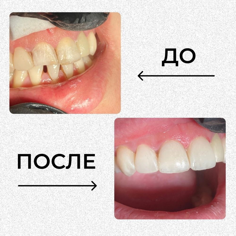 Клинический случай