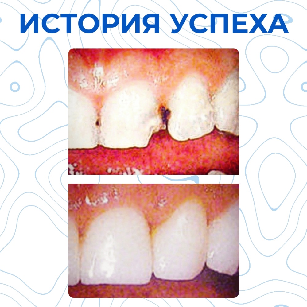 Клинический случай