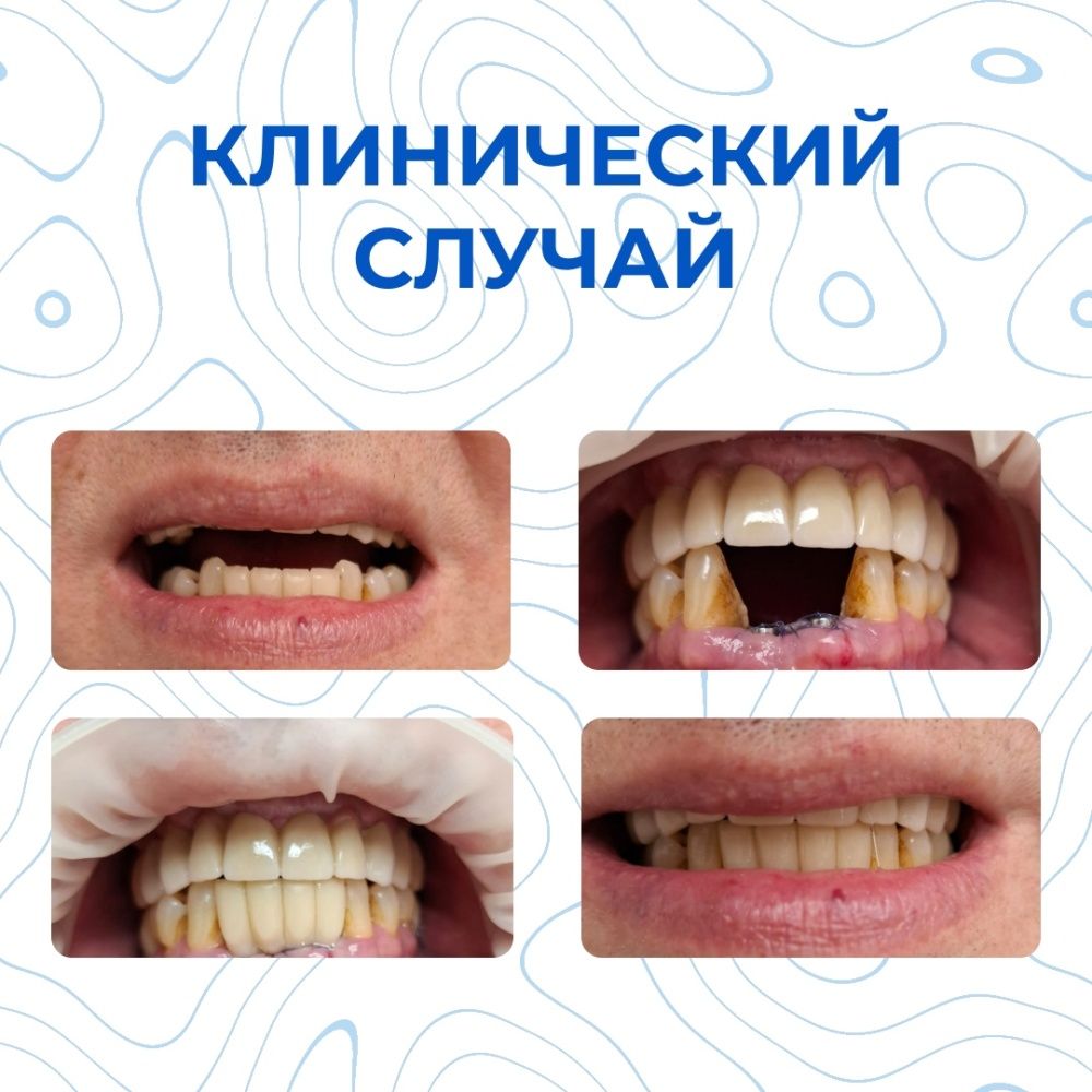 Клинический случай