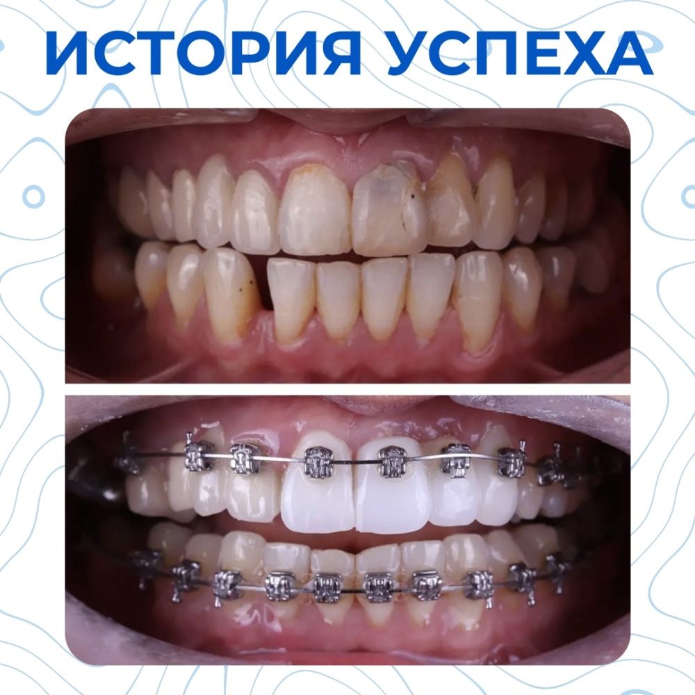 Клинический случай