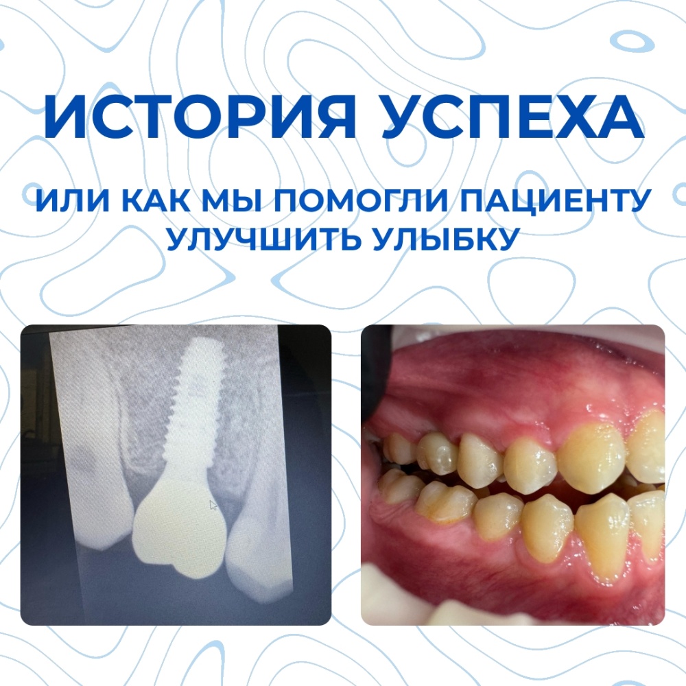 Клинический случай