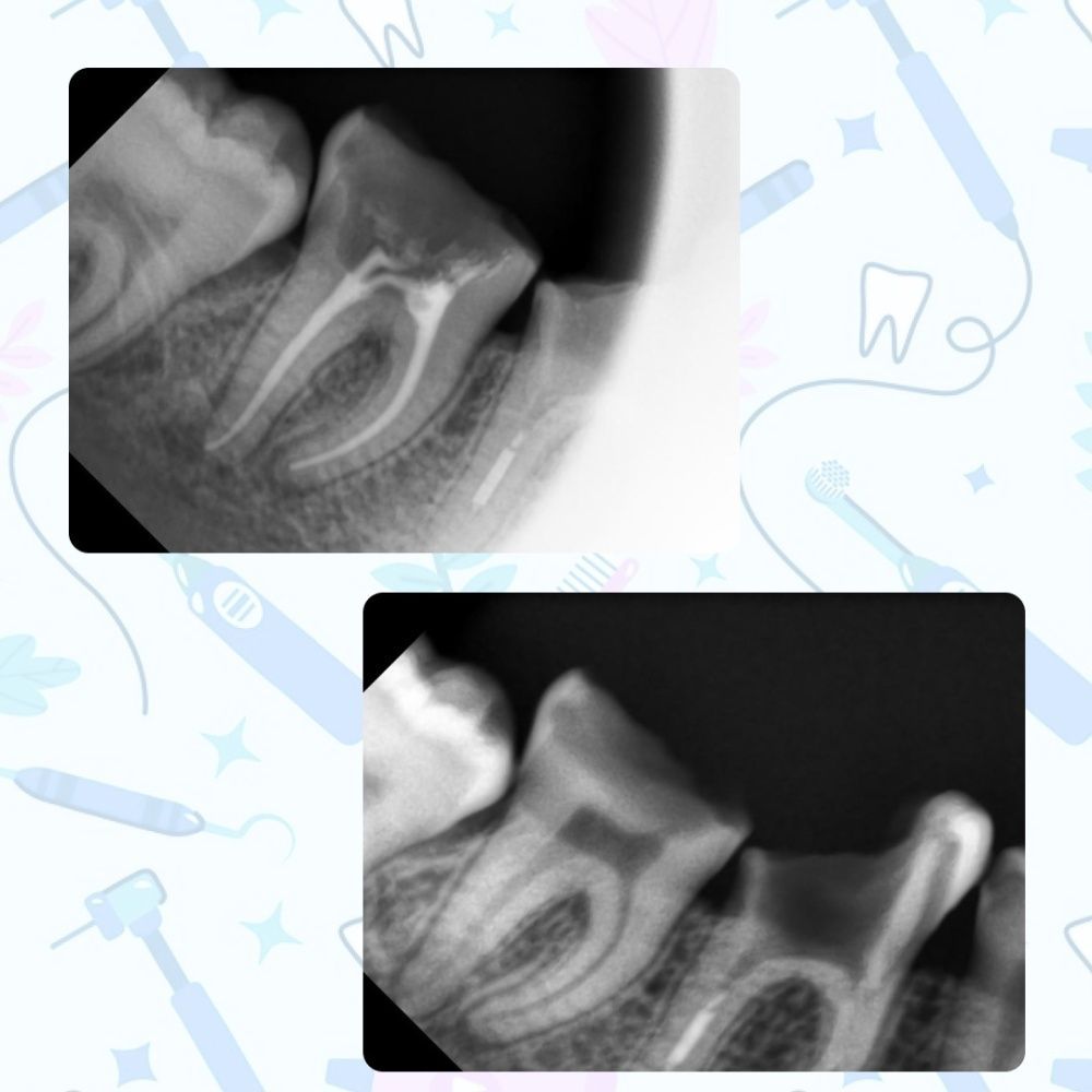 Клинический случай