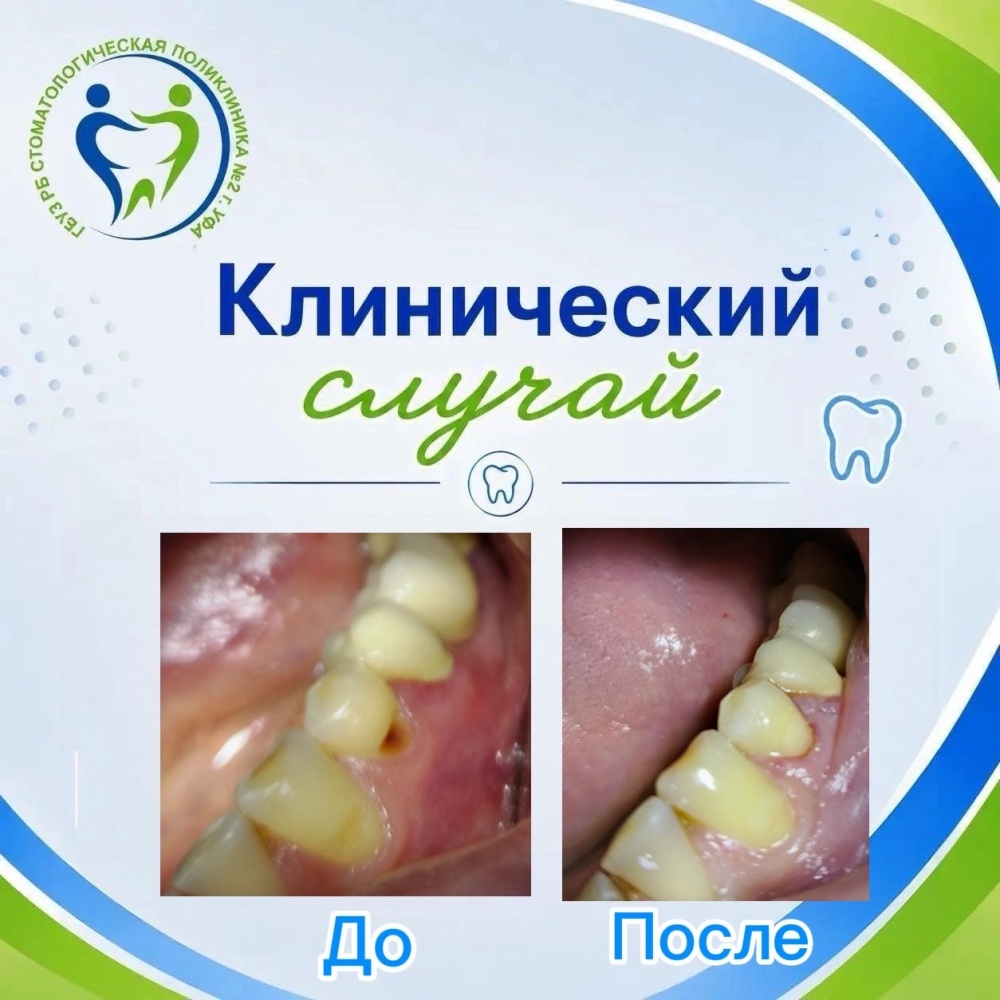 Клинический случай