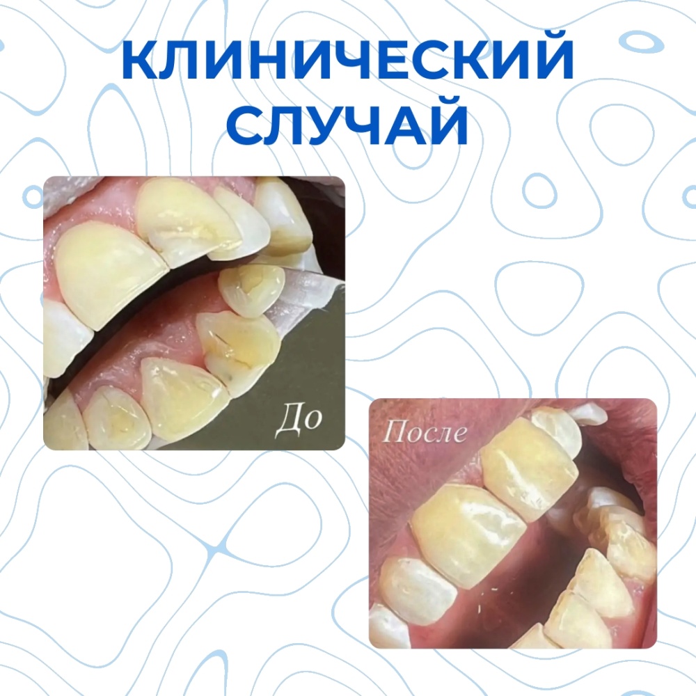 Клинический случай