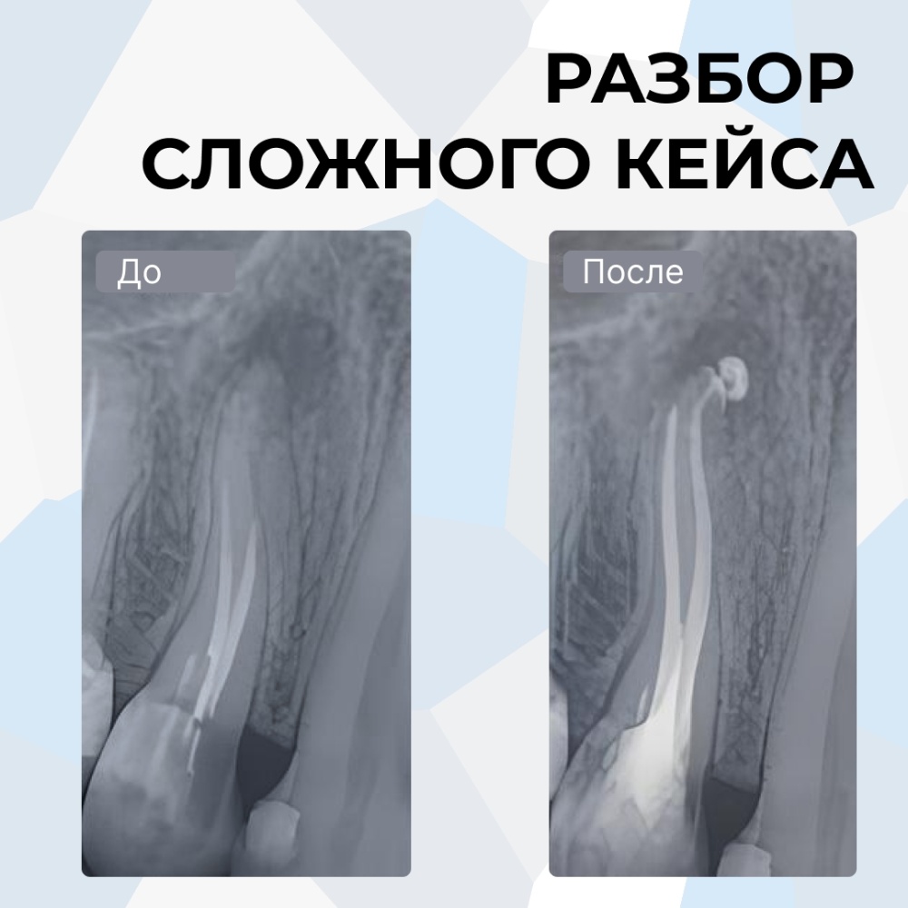 Клинический случай