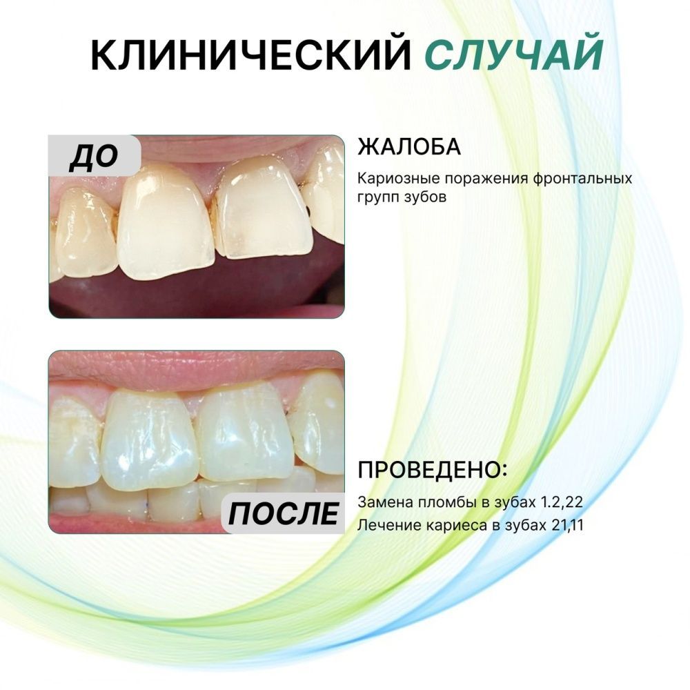 Клинический случай