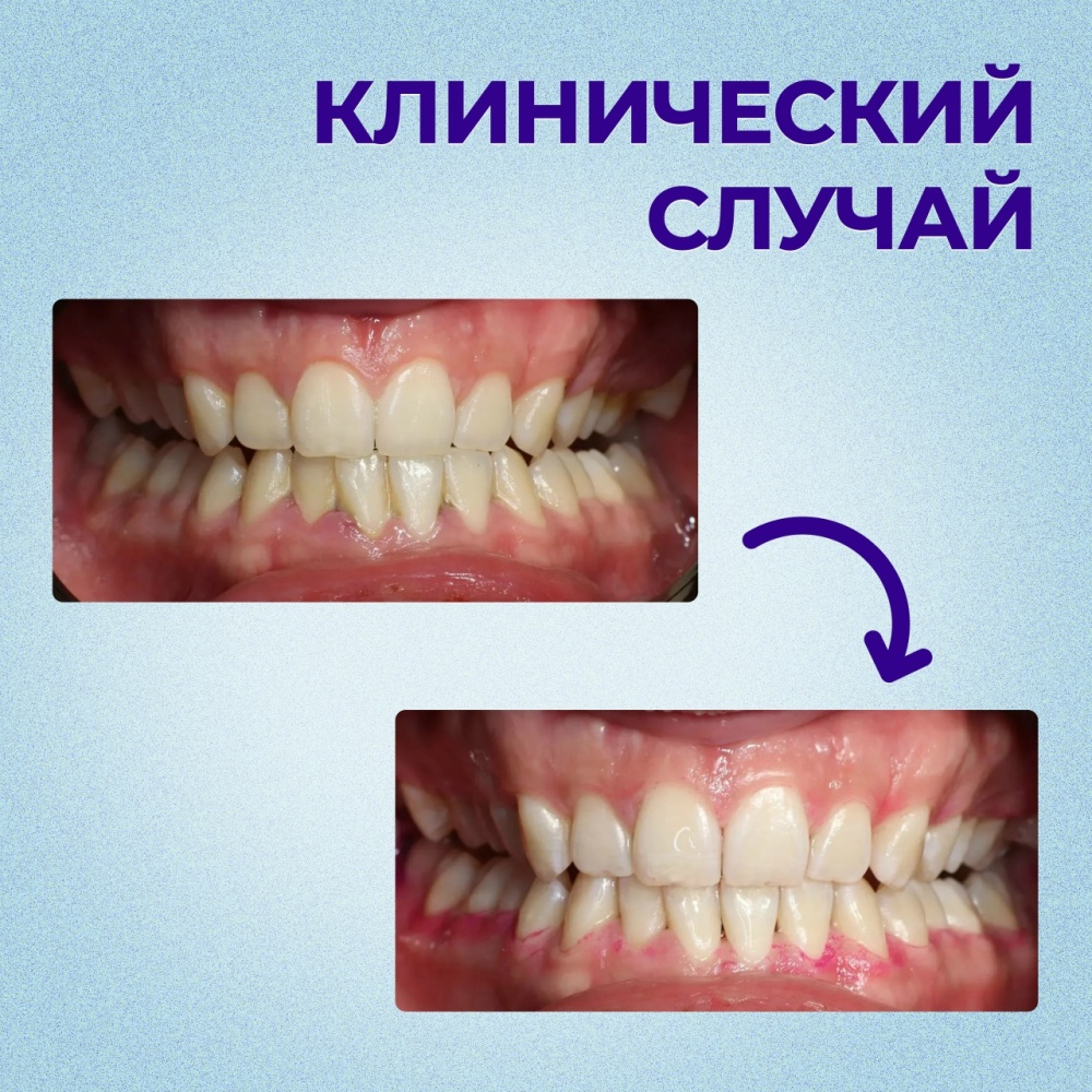 Итоги личного приёма граждан