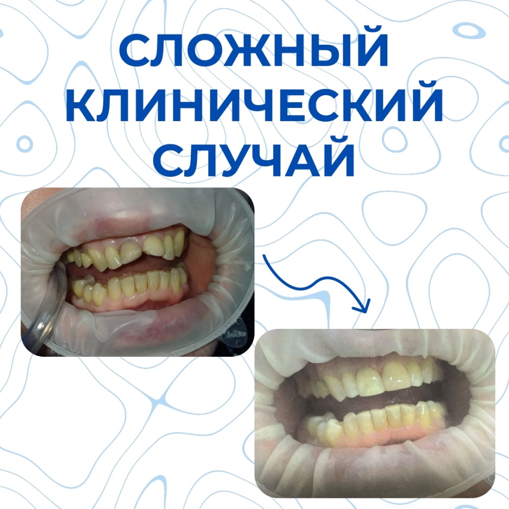 Клинический случай