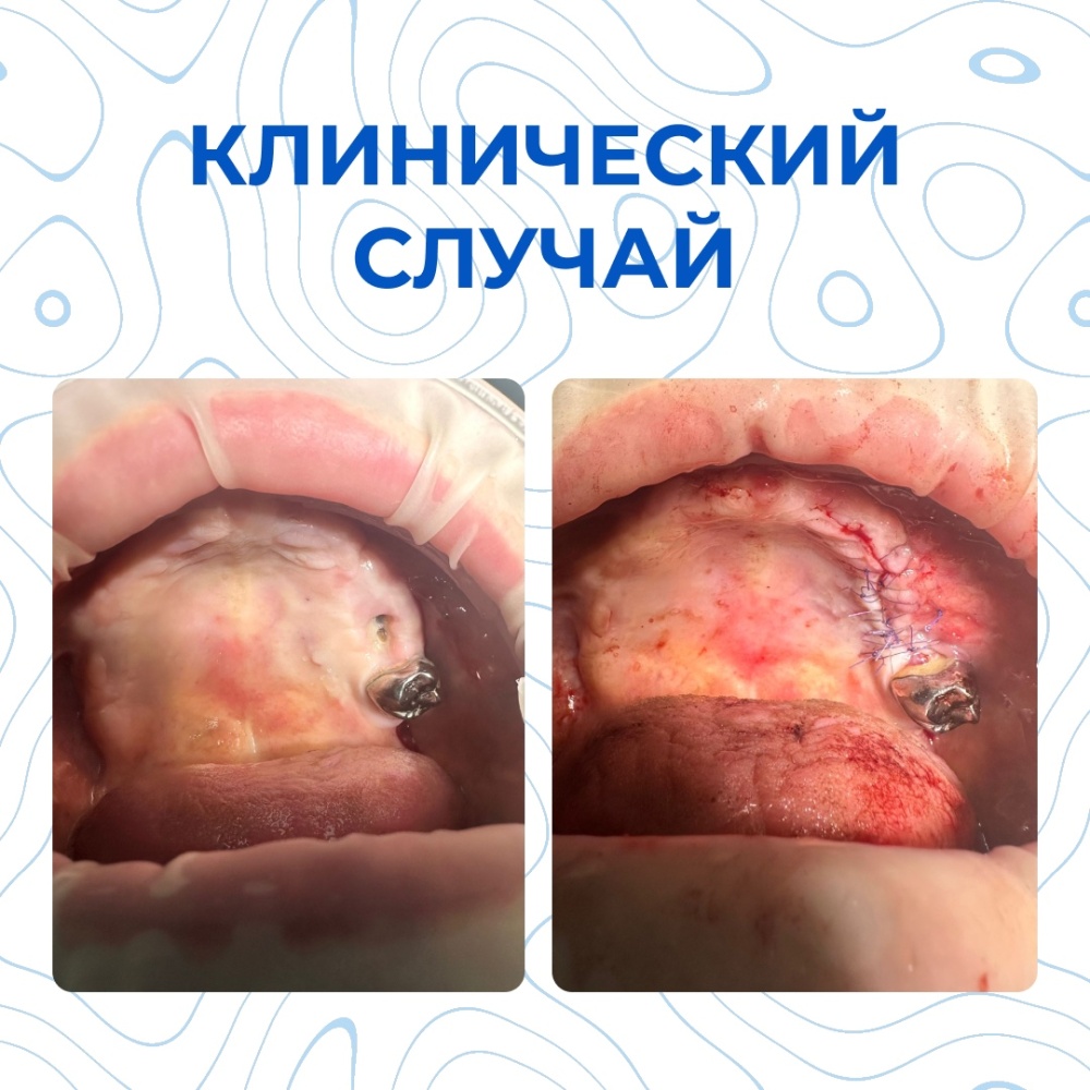 Клинический случай