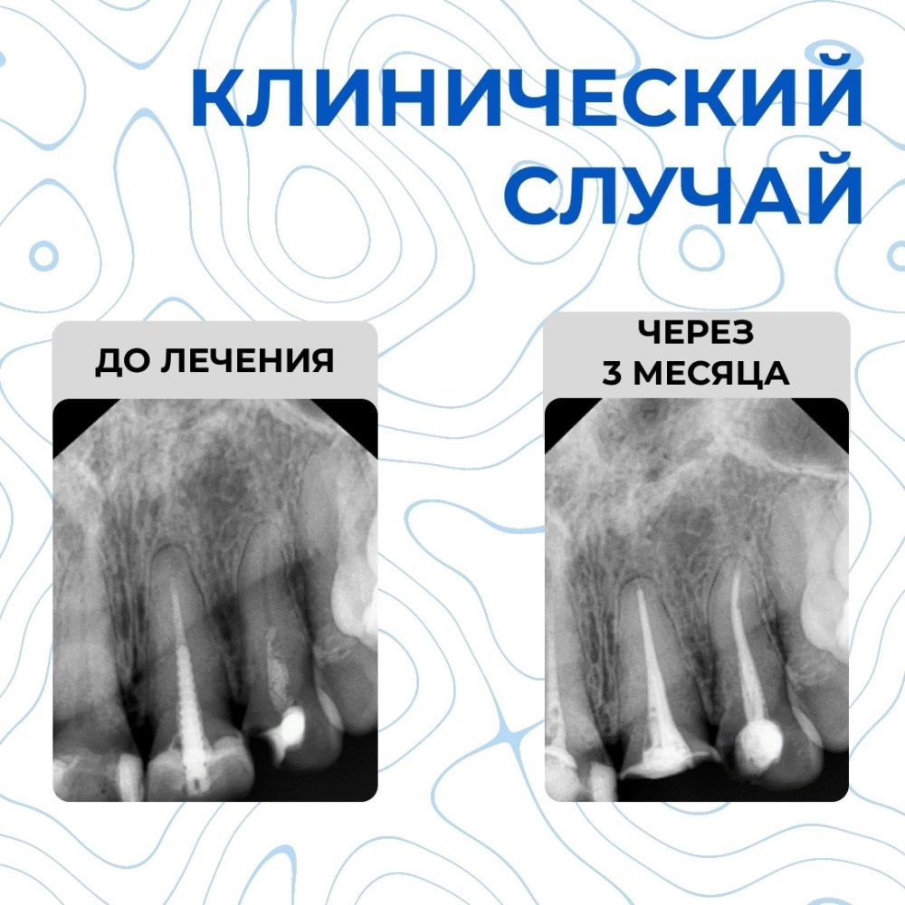 Клинический случай