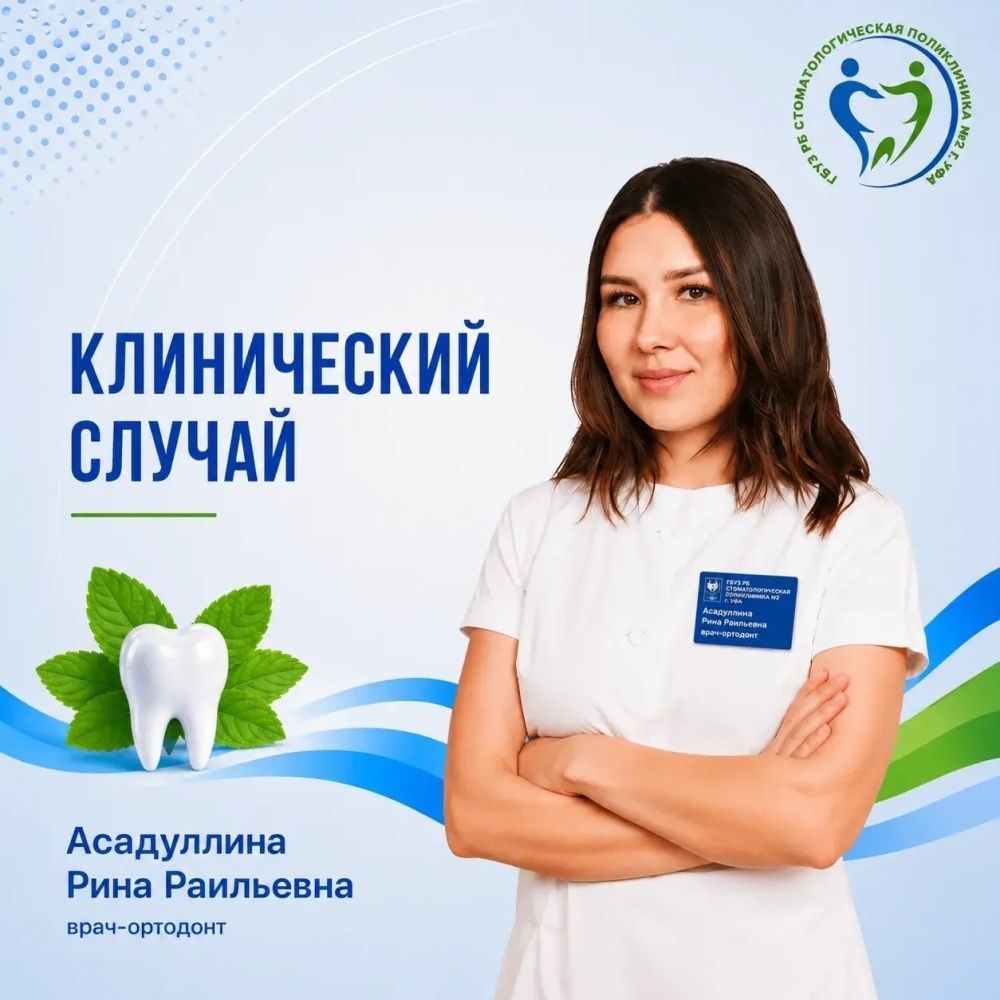 Клинический случай: лечение выраженного дефицита места на верхней челюсти и глубокого травмирующиюшего прикуса