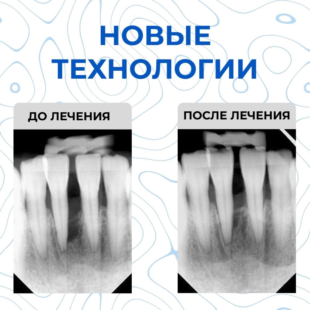 Новые технологии, используемые в нашей клинике