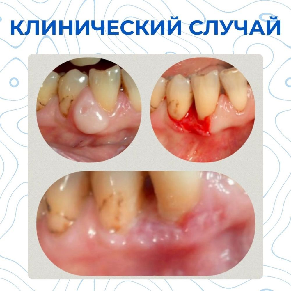 Клинический случай