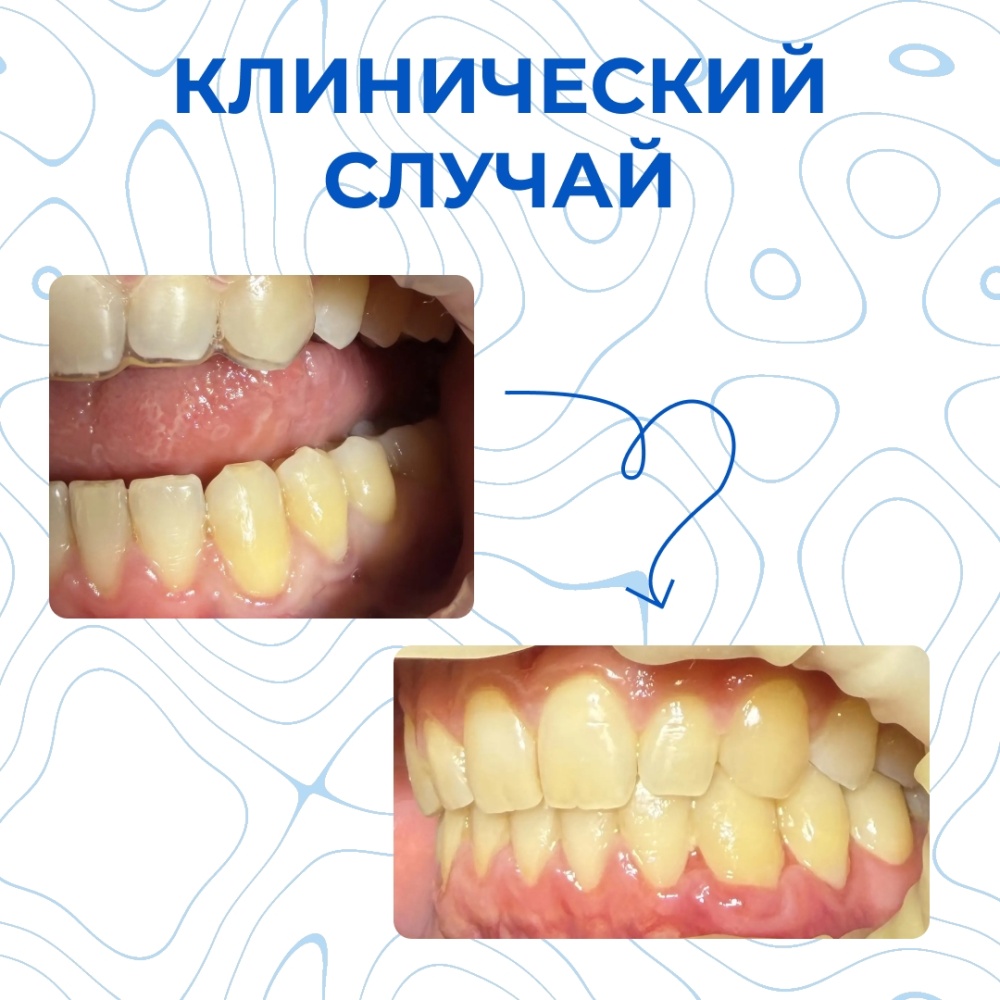 Клинический случай