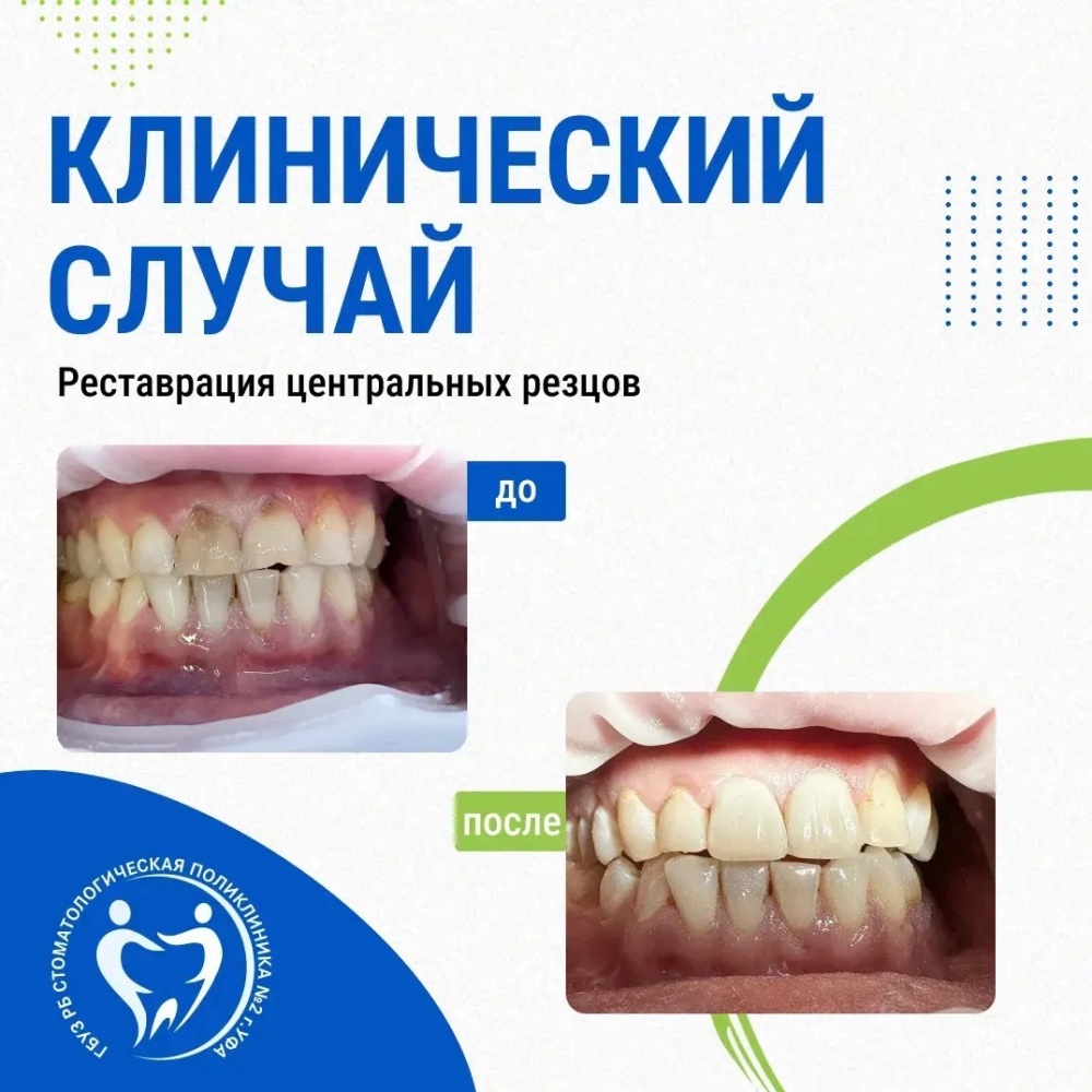 Клинический случай