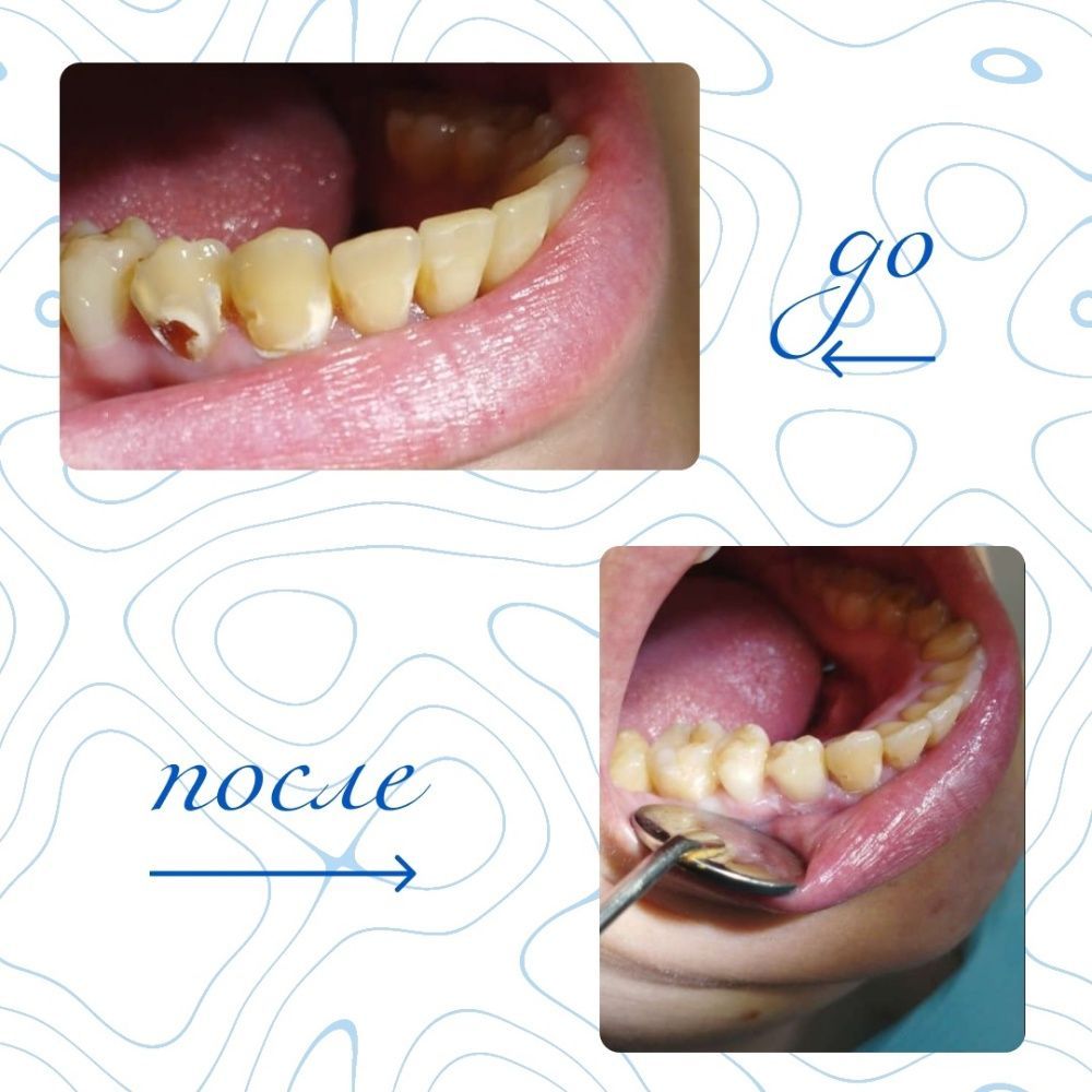 Клинический случай