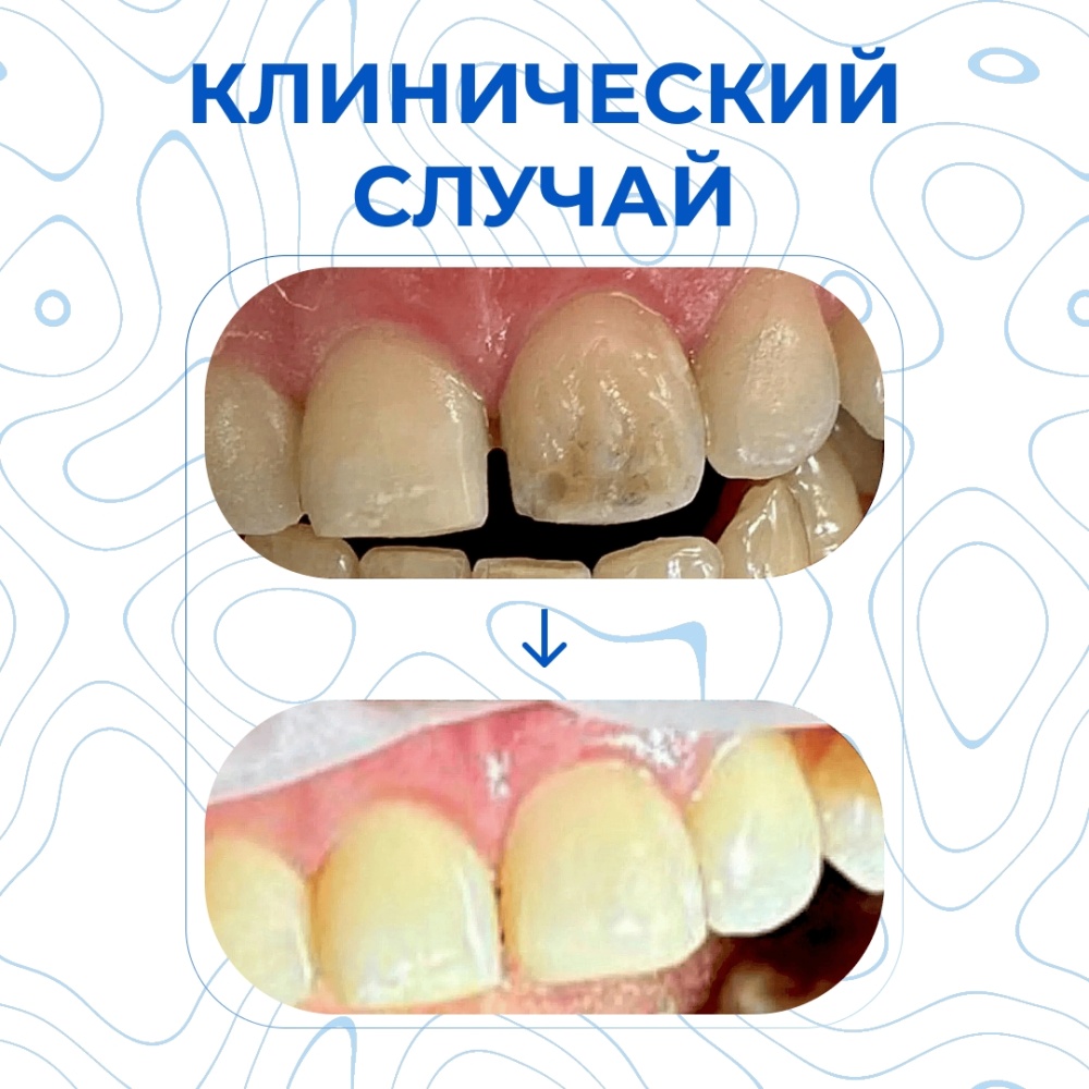 Клинический случай