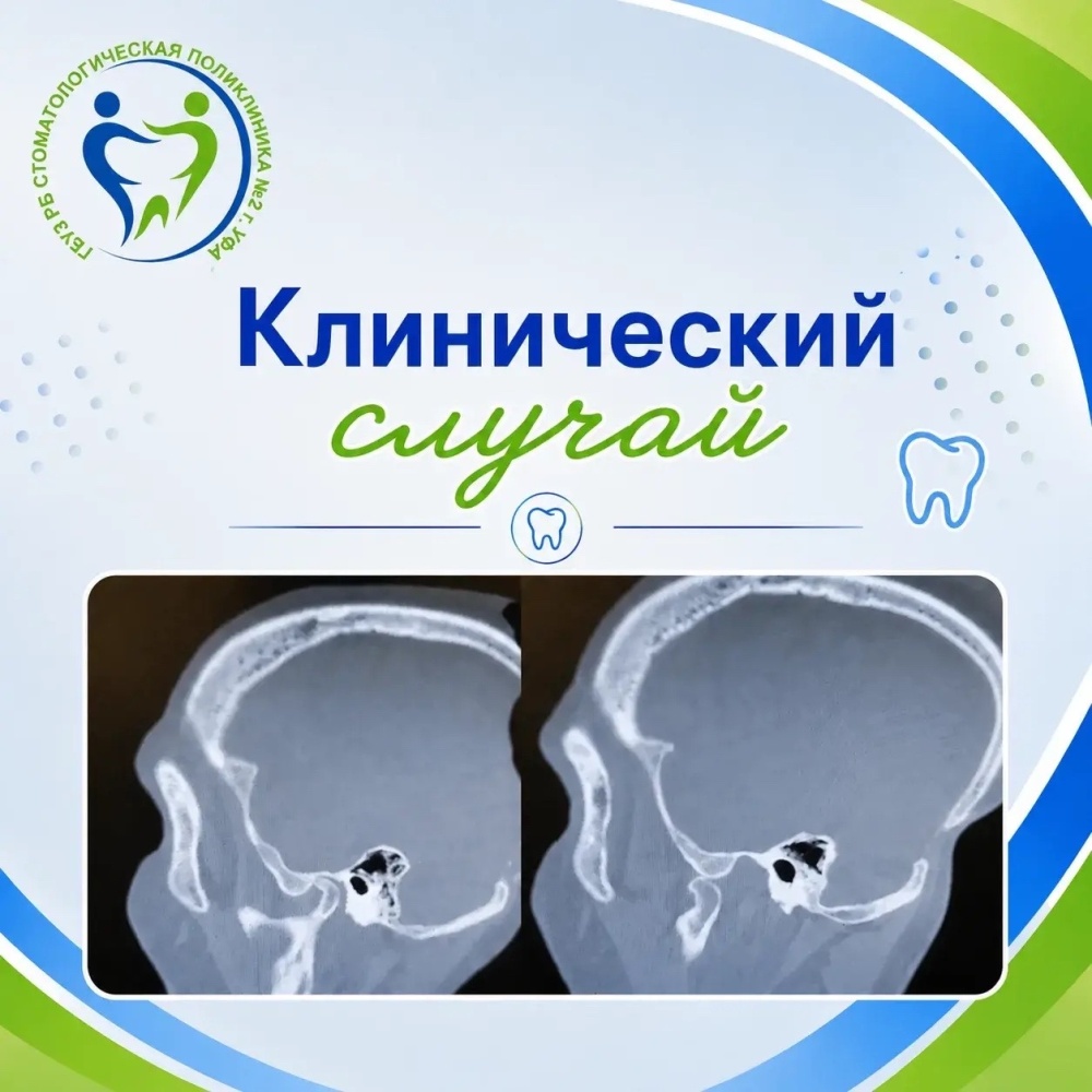 Клинический случай