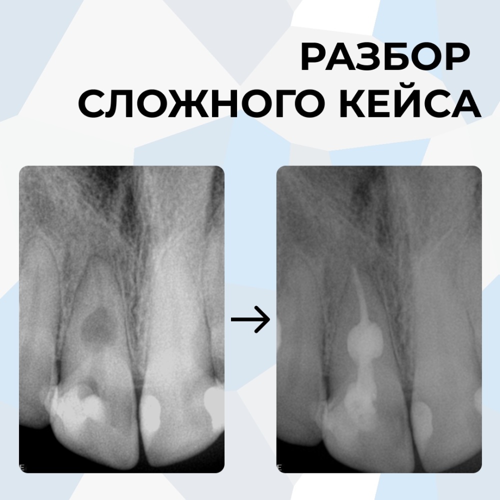 Клинический случай